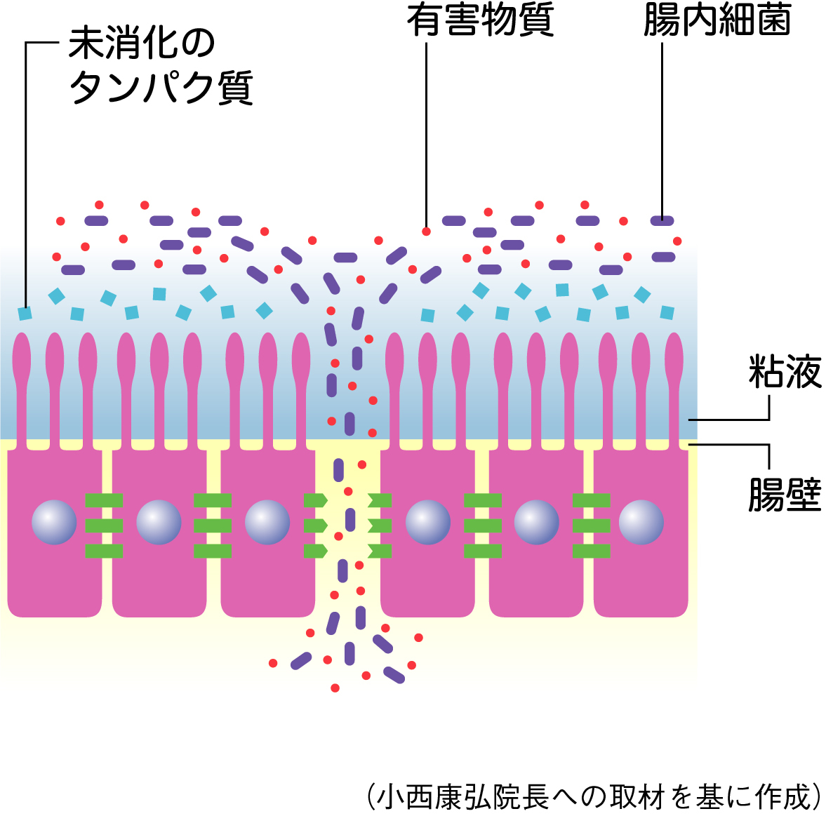 腸管細胞の隙間が広がるリーキーガット症候群